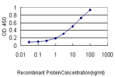 E - S100A4 Antibody (monoclonal) (M01) AT3757a